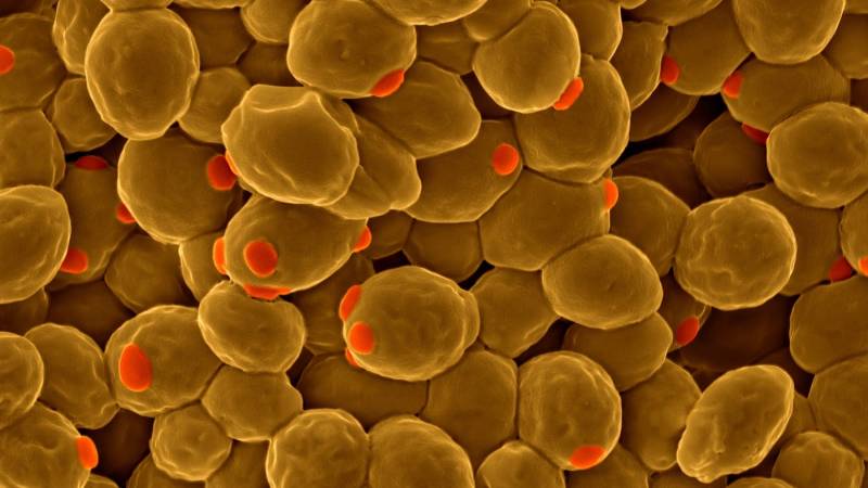 Hunger and war. Yeast instead of pork